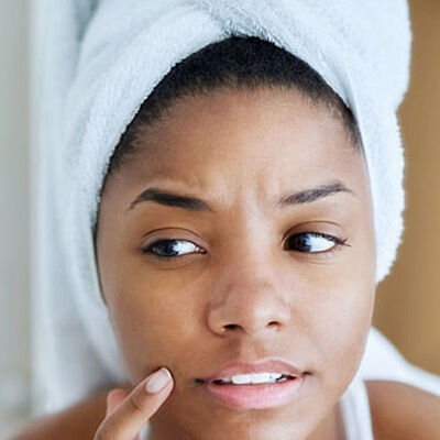 Skin care for blackheads discount